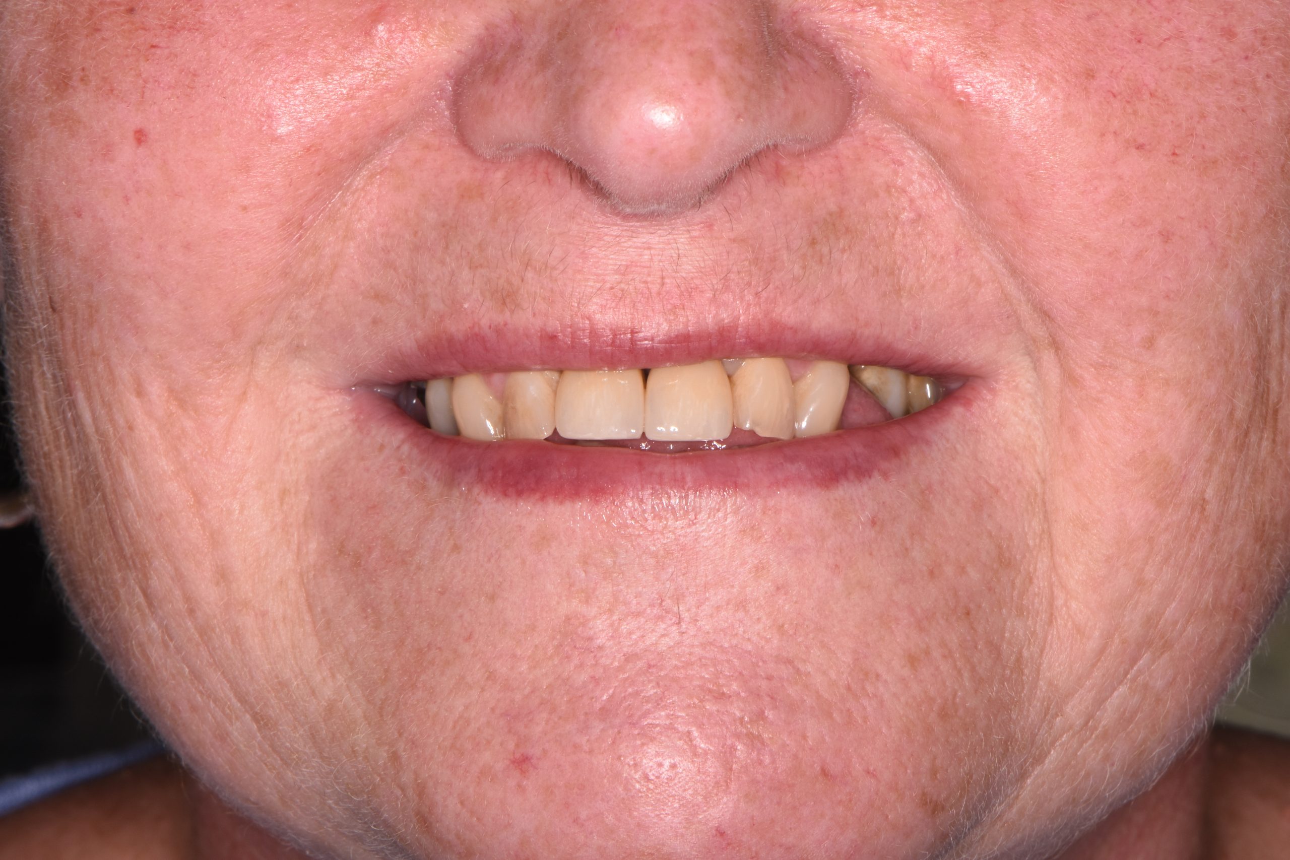 Sharon Jackson after Sharon Jackson after